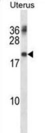 PMP22 Antibody