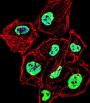 Heterogeneous Nuclear Ribonucleoprotein D (HNRNPD) Antibody