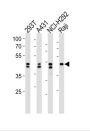 Heterogeneous Nuclear Ribonucleoprotein D (HNRNPD) Antibody