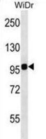 Integrin Beta 7 (ITGB7) Antibody