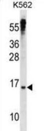 Max Dimerization Protein 3 (MXD3) Antibody