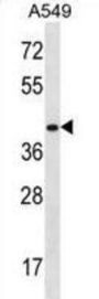 HOXD11 Antibody