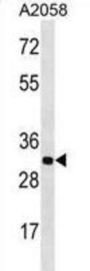 Olfactory Receptor Family 2 Subfamily T Member 11 (gene/pseudogene) (OR2T11) Antibody