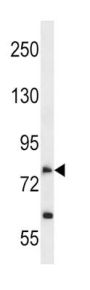 Solute Carrier Family 28 Member 2 (SLC28A2) Antibody