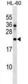 DNAJC24 Antibody
