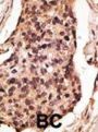 Sialic Acid Binding Ig Like Lectin 8 (SIGLEC8) Antibody