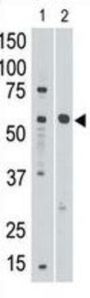 Sialic Acid Binding Ig Like Lectin 8 (SIGLEC8) Antibody