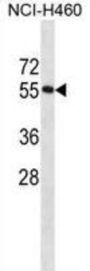RBM45 Antibody