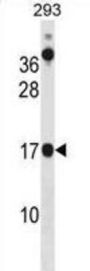 Coiled-Coil-Helix-Coiled-Coil-Helix Domain Containing 10 (CHCHD10) Antibody