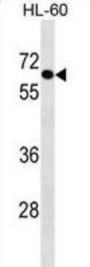 Absent In Melanoma 1-Like Protein (AIM1L) Antibody