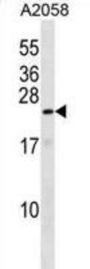 ZN673 Antibody