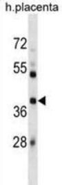 E3 Ubiquitin-Protein Ligase SIAH1 (SIAH1) Antibody