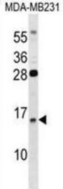 Guanylate Cyclase Activator 2B (GUCA2B) Antibody