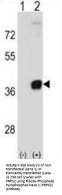 Ribose-Phosphate Pyrophosphokinase 2 (PRPS2) Antibody
