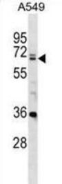 DEAD (Asp-Glu-Ala-Asp) Box Polypeptide 28 (DDX28) Antibody