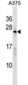 SAP Domain-Containing Ribonucleoprotein (SARNP) Antibody