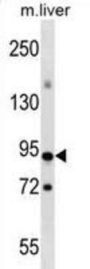 CXXC-Type Zinc Finger Protein 1 (CXXC1) Antibody