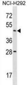 Actin Like 7B (ACTL7B) Antibody