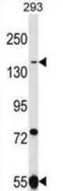 UHRF1BP1L Antibody