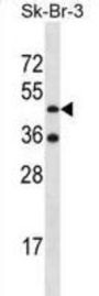 Ethanolamine Kinase 2 (ETNK2) Antibody