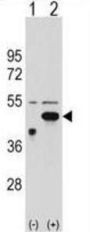 Ethanolamine Kinase 2 (ETNK2) Antibody