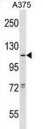 Taste Receptor Type 1 Member 1 (TAS1R1) Antibody