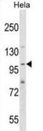 SH3 And PX Domains 2A (SH3PXD2A) Antibody