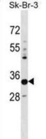 Phytanoyl-CoA Dioxygenase Domain-Containing Protein 1 (PHYHD1) Antibody