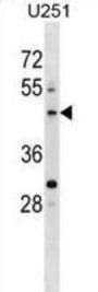 Pleckstrin Homology Domain Containing O2 (PLEKHO2) Antibody