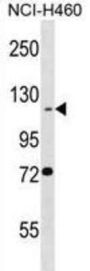 BEND3 Antibody