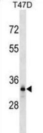 Dynein Axonemal Light Intermediate Chain 1 (DNALI1) Antibody
