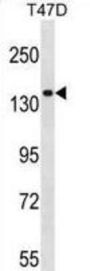 Myosin IE (MYO1E) Antibody