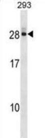 Deoxycytidylate Deaminase (DCTD) Antibody