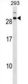 Cell Division Cycle Associated 4 (CDCA4) Antibody