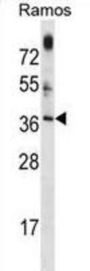 Mitochondrial Ribosome Associated GTPase 1 (MTG1) Antibody