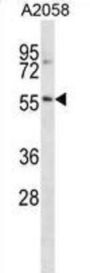 Nucleus Accumbens-Associated Protein 2 (NACC2) Antibody