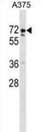 USP17L2 Antibody