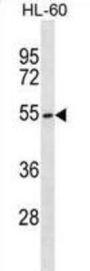 Beta-1,4-Mannosyl-Glycoprotein 4-Beta-N-Acetylglucosaminyltransferase (MGAT3) Antibody