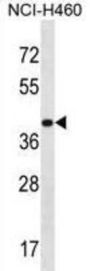 Mitochondrial Ribosomal Protein S9 (MRPS9) Antibody