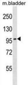 Topoisomerase III Beta (TOP3B) Antibody