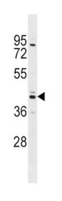 Sex Hormone-Binding Globulin (SHBG) Antibody