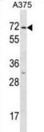 KRT75 Antibody
