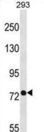 Phosphate-Regulating Neutral Endopeptidase (PHEX) Antibody