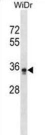 Phosphatidylinositol Glycan L (PIGL) Antibody