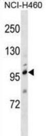 Transient Receptor Potential Cation Channel Subfamily C Member 1 (TRPC1) Antibody