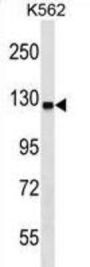 Ubiquitin-Like Modifier-Activating Enzyme 6 (UBA6) Antibody