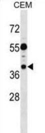 TSSC1 Antibody