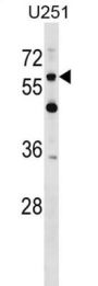 Chondroitin Sulfate Proteoglycan 5 (CSPG5) Antibody