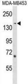 Rho Guanine Nucleotide Exchange Factor 11 (ARHGEF11) Antibody