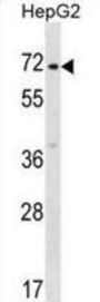 Zinc Finger Protein 155 (ZNF155) Antibody